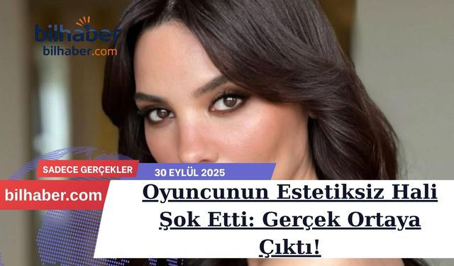 Oyuncunun Estetiksiz Hali Şok Etti: Gerçek Ortaya Çıktı!