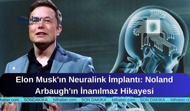 Elon Musk'ın Neuralink İmplantı: Noland Arbaugh'ın İnanılmaz Hikayesi