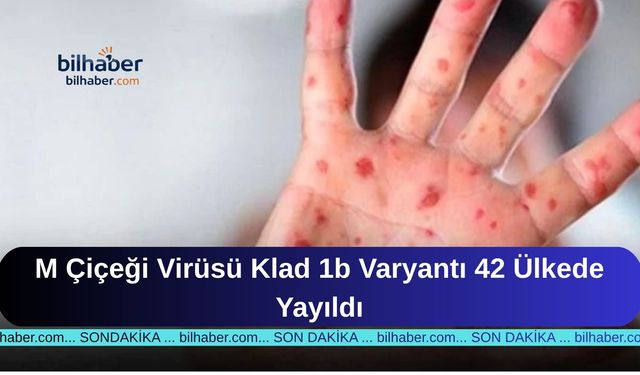 M Çiçeği Virüsü Klad 1b Varyantı 42 Ülkede Yayıldı
