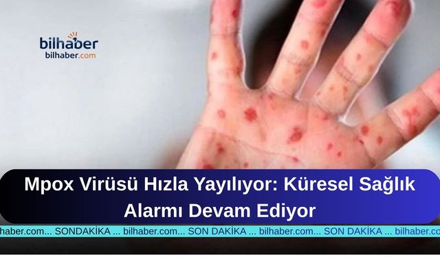 Mpox Virüsü Hızla Yayılıyor: Küresel Sağlık Alarmı Devam Ediyor